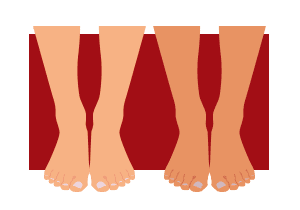 Legs